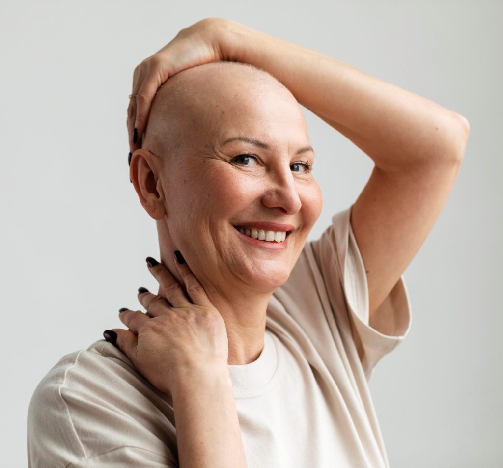 Pérdida de cabello como consecuencia del tratamiento oncológico